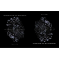 Transtraterrestrial: Dark Matter and Black Divinities