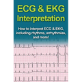 ECG & EKG Interpretation: How to interpret ECG & EKG, including rhythms, arrhythmias, and more!