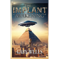 The Implant Awakening