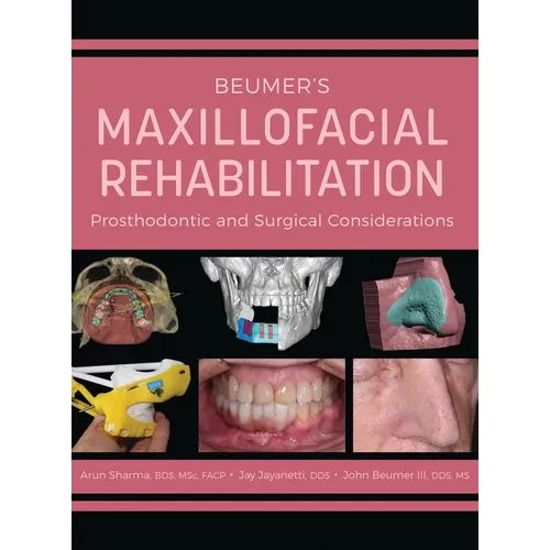 Beumer's Maxillofacial Rehabilitation: Prosthodontics and Surgical Considerations